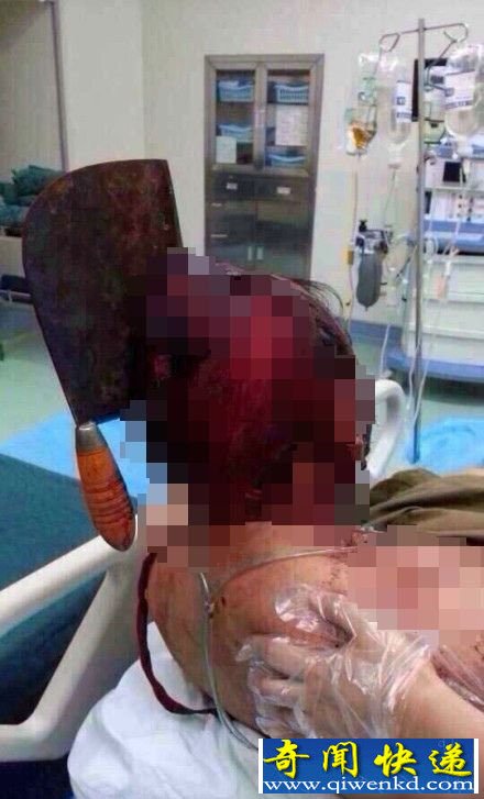 妻子拿菜刀将出轨丈夫的脑袋劈成了两半 血腥异常