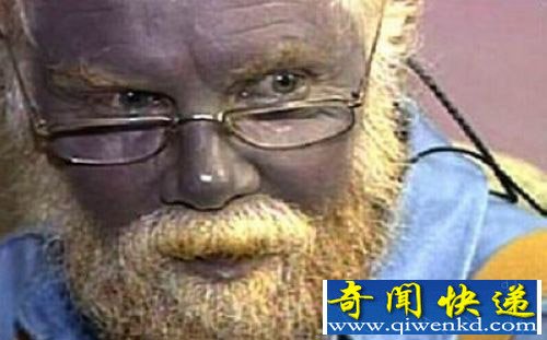 Ѫ֮ ɫѪҺ