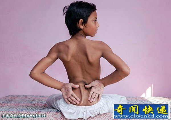 印度一男孩长着神奇尾巴 在当地被奉为神灵信徒朝拜
