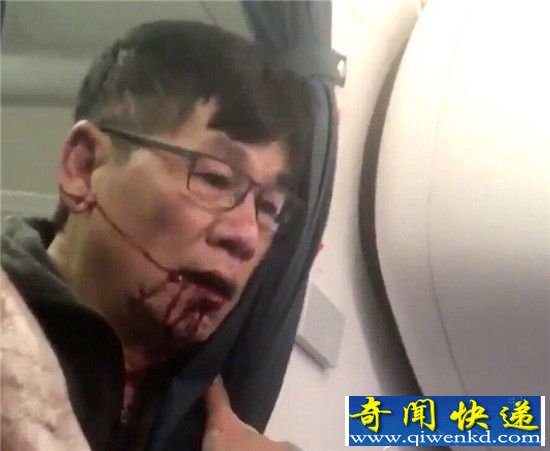 美联航强制乘客下机 华裔医生被打出血强行拖下飞机