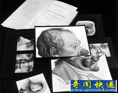 沿ͼƬ