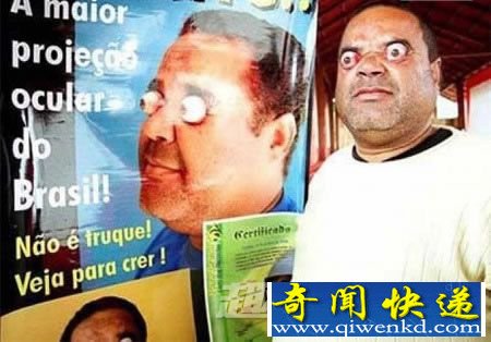 眼睛爆出眼框的人
