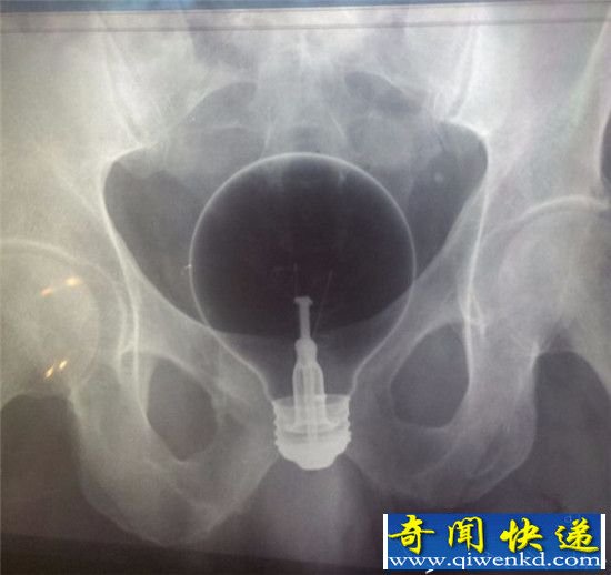 人的下体