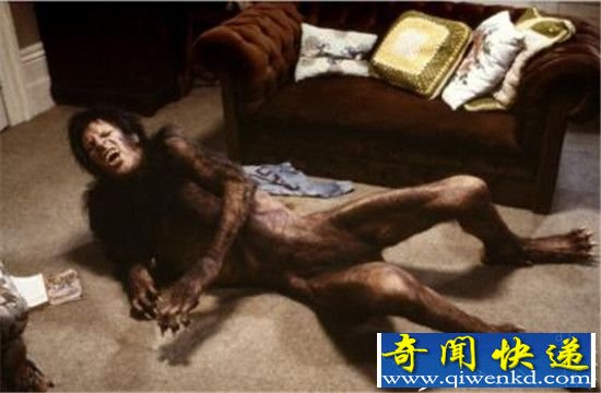 科学史六大悬案 狼人家族之谜