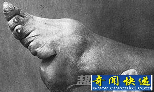 陋习 金莲 面目 三寸 真实