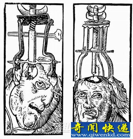 环锯术
