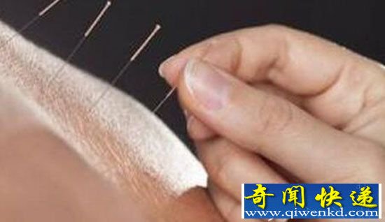 女子做针灸扎破肺:做针灸竟被扎破肺 小命差点不保