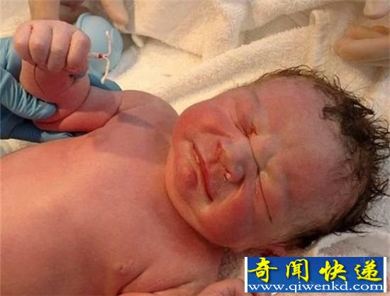 婴儿手握避孕环出生:想弄死我?没那么容易!