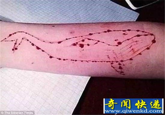 蓝鲸疑流入香港:3人网上发文自残 如何拒绝蓝鲸游戏?