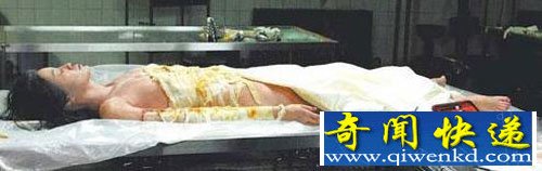 特异功能 女尸 医生 复活 解剖