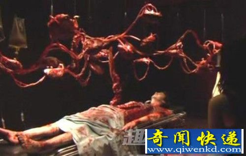 特异功能 女尸 医生 复活 解剖