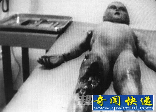 外星人遗骸