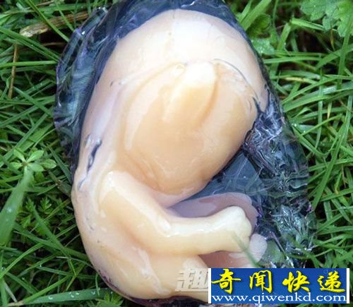 胎儿