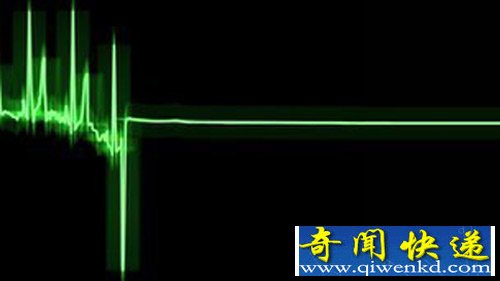 人类濒死经历的真正原因