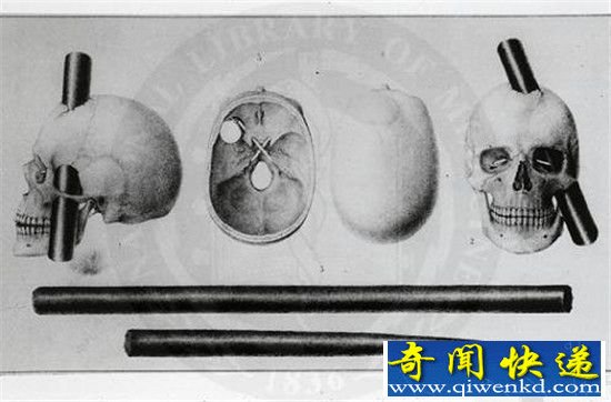 世界十大起死回生事件 老天爷都杀不死!