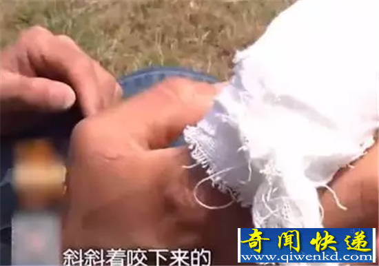 男子动物园喂熊被咬掉手指