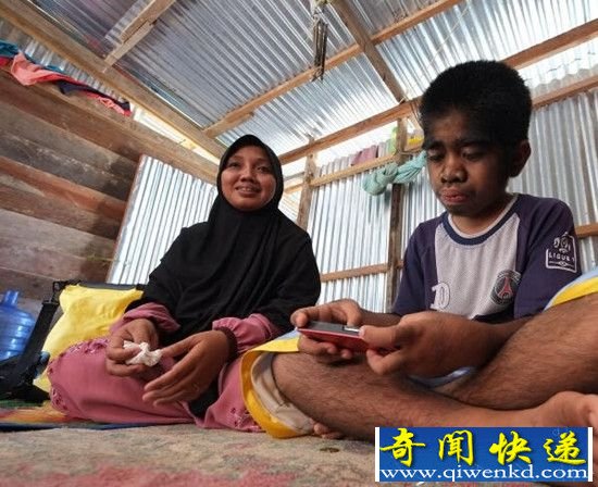 印尼狼孩自认被神选中 拒绝接受治疗