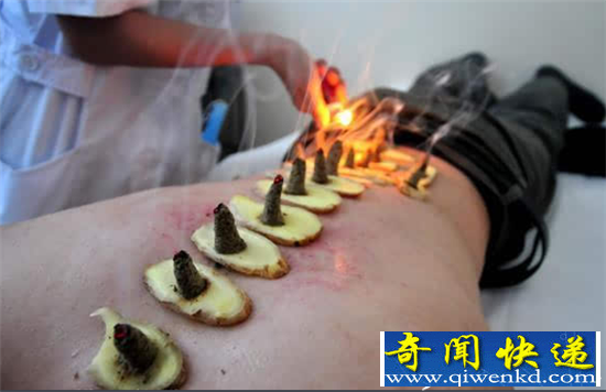 盘点奇葩的重口味养生 尿疗卧轨电疗长见识