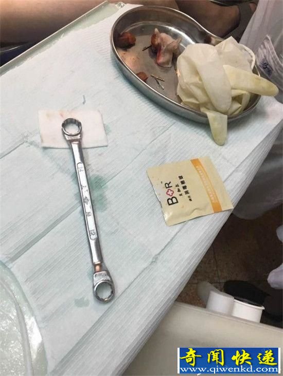 男子下体被扳手套住17小时 最终被口腔科医生拯救