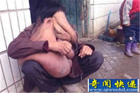 人头蛇身怪物震惊全球 或因千年极寒基因突变