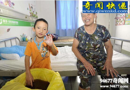 八岁男童长螃蟹手三度遭到遗弃,最终矫形成功