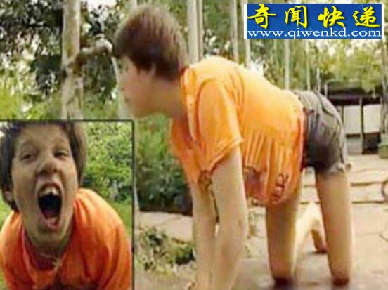 乌克兰狗孩,四肢爬行啃食生肉(被狗养育5年)