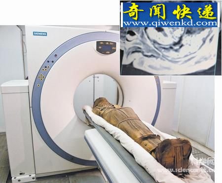 古埃及人也有心脏病(图)