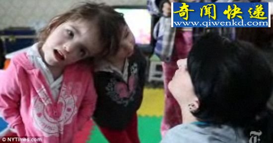 这两个小女孩被认为具有独一无二的丘脑桥,共用一部分控制感官知觉的大脑。 新研究发现连体人可共享思想分享对方感受