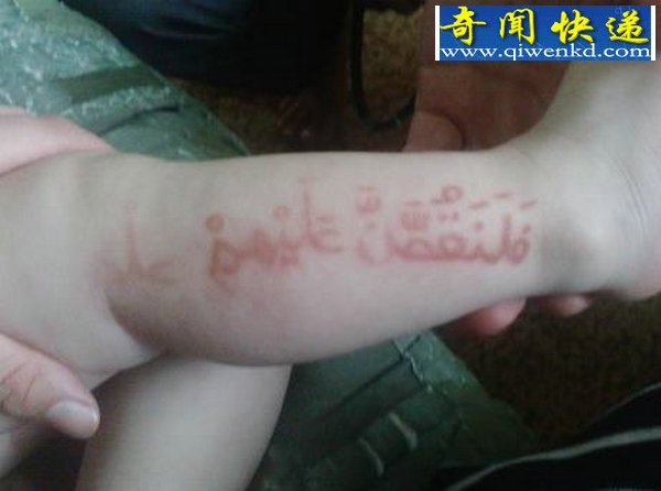 婴儿腿上显现古兰经文引发狂热朝拜