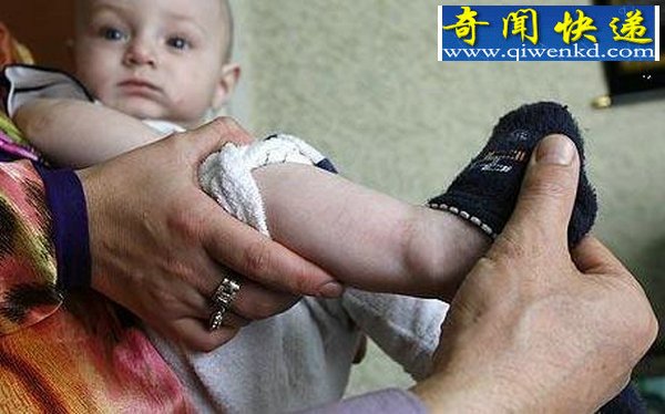 婴儿腿上显现古兰经文引发狂热朝拜