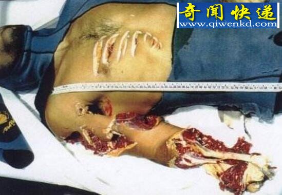 实拍鲨鱼吃人全过程,被鲨鱼咬碎的尸体图片