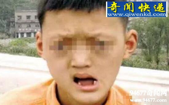 重庆僵尸男孩,发病时虚吸食人血(患有癔症)
