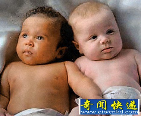 伍德兄弟的婴儿照 (图) 揭秘罕见黑白双胞胎背后科学