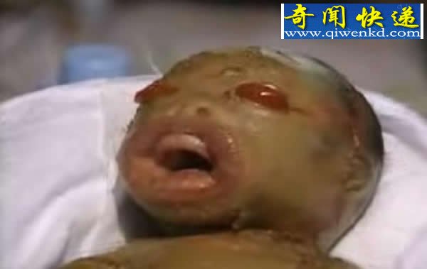 外星魔婴、俄罗斯猪人、巴西狗嘴男、缅甸恶媳人变狗真相揭秘