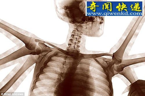 붯ӽ