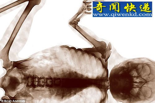 붯ӽ