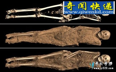 女性木乃伊被检出患有心脏病