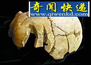 在牛津大学地下发现的这些遗骨头部有撞击形成的裂痕。 牛津大学地下遗骸揭英格兰历史谜题